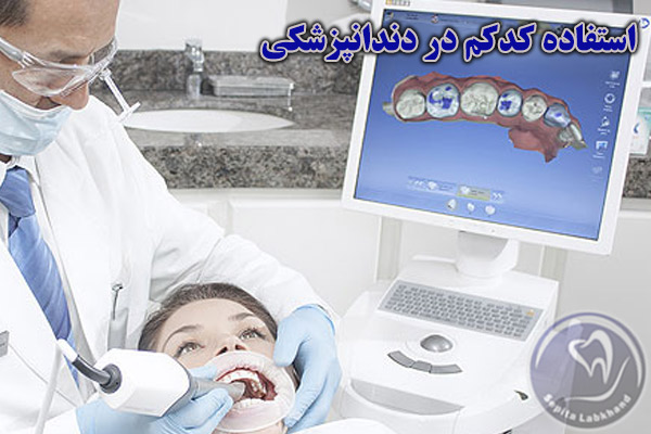 استفاده کئکم در دندانپزشکی