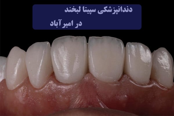 دندانپزشکی در امیراباد