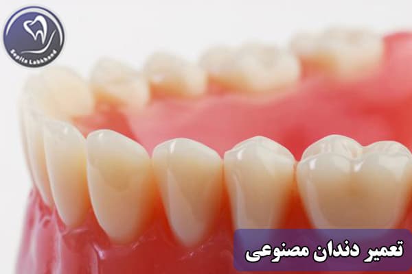 تعمیر دندان مصنوعی