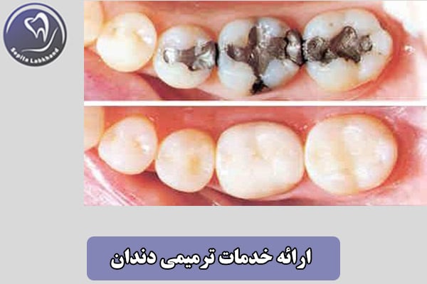 ارائه خدمات ترمیمی دندان