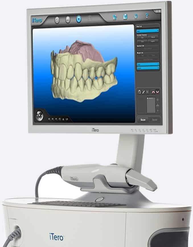 دستگاه اسکنر دندان