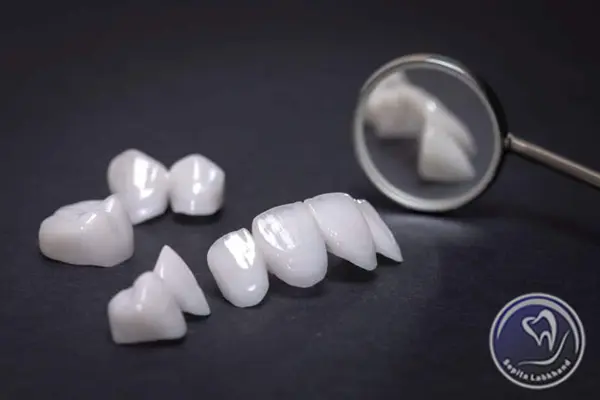 آیا دندانپزشک در مقدار تراش دندان برای روکش زیرکونیا نقش دارد؟