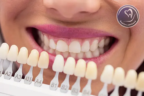 روکش دندان زیرکونیا چیست؟