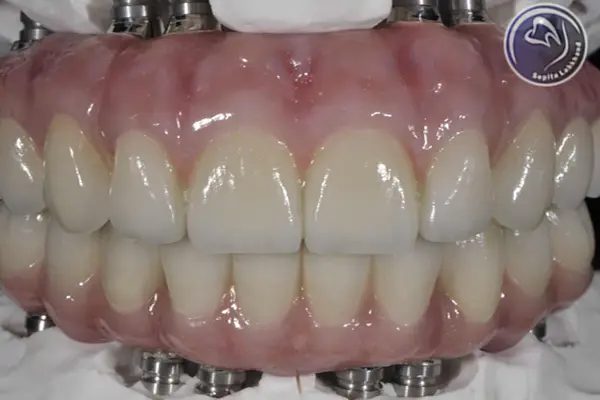 دندانپزشکی سپیتا لبخند، بهترین مرجع پروتز دندان