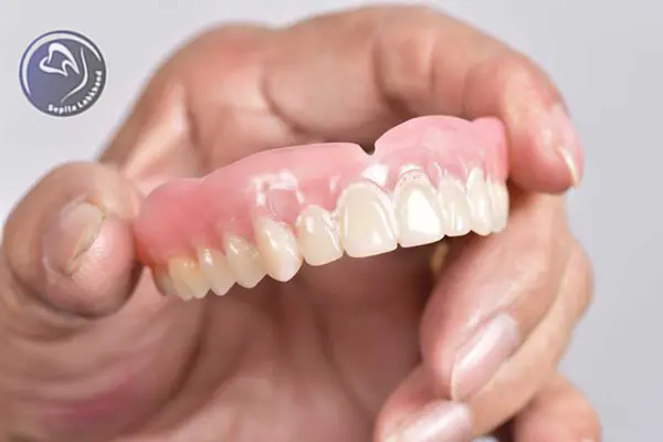 پروتز دندانی متحرک