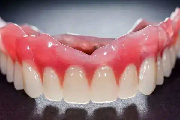 پروتز دندان متحرک چیست؟
