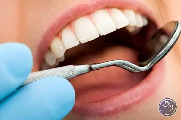 آنچه باید درباره روکش دندان عصب کشی شده بدانید!
