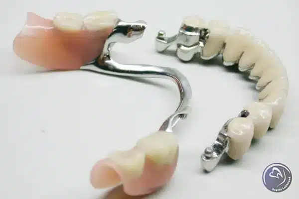 بهترین پروتز دندان ژله ای را از کجا تهیه کنیم؟
