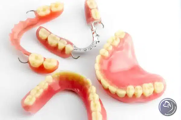 انواع پروتز دندان جزئی را بشناسید!