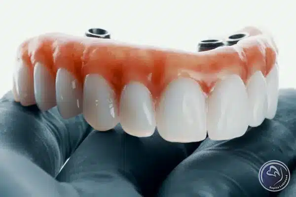 ماندگارترین پروتزهای ثابت دندان را از کجا تهیه کنیم؟