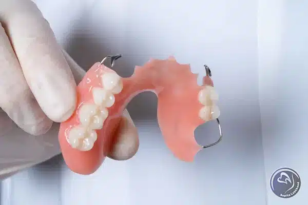 پروتز دندان جزئی متحرک چه مزایایی دارد؟