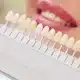 بهترین رنگ روکش دندان