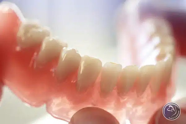 مواردی که قبل از پروتز دندان باید بدانید