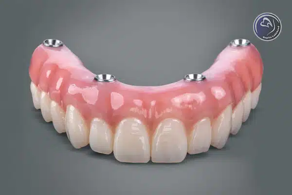 نکات مراقبت از پروتز دندان ثابت