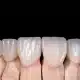 روکش دندان درد دارد؟